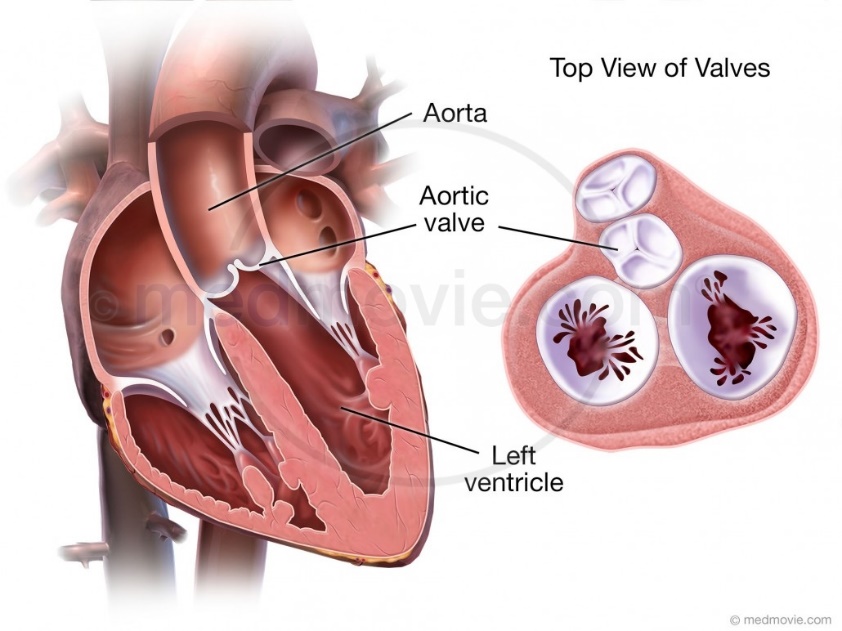 Aortic Valve