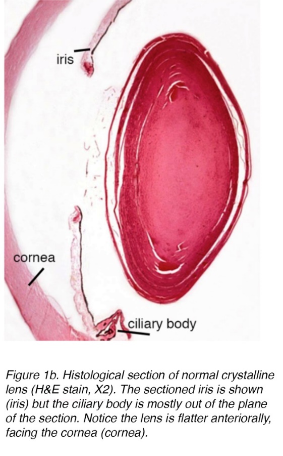 Crystalline Lens and Cataract by Joah F. Aliancy and Nick Mamalis – Webvision