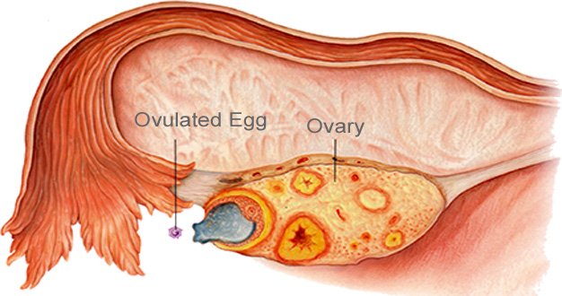Bay IVF - Palo Alto | Conception & Infertility