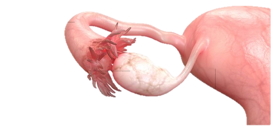 Fallopian Tube High Res Stock Images | Shutterstock