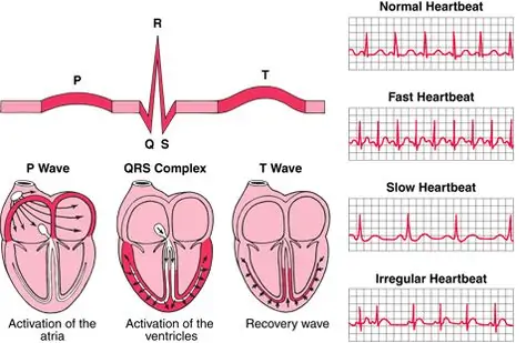 18 Cardiac images ideas | p wave, cardiac, heart rhythms
