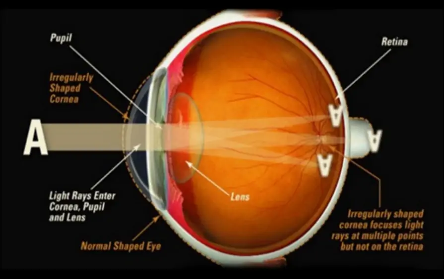 How the Eye Works - HubPages