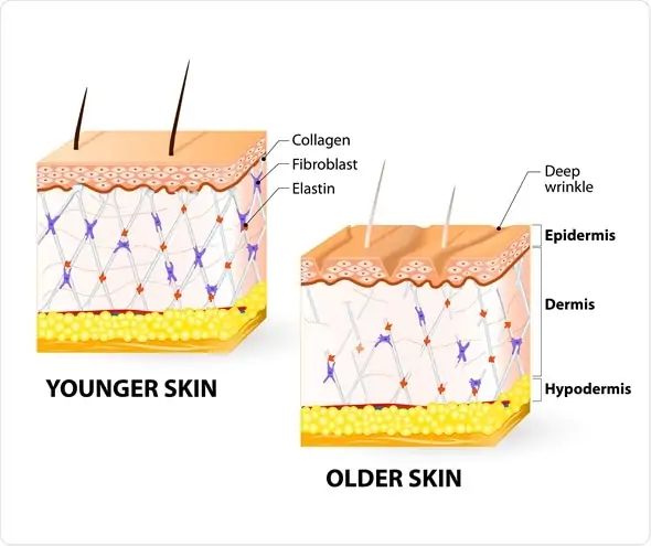 What is the Dermis?