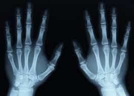 X-rays - Electromagnetic Spectrum